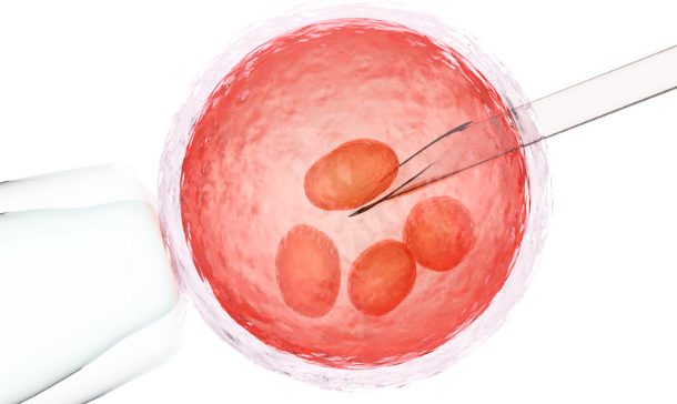 In Vitro Fertilization