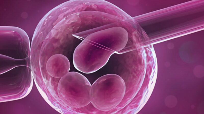 best IVF centre in Chennai