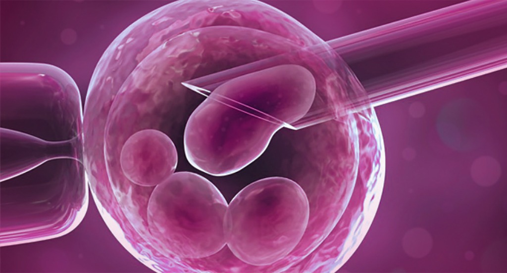 Read more about the article How Preimplantation Genetic Testing Can Improve IVF Success Rates