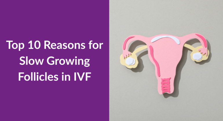 Top 10 Reasons for Slow Growing Follicles in IVF Top 10 Reasons for Slow Growing Follicles in IVF