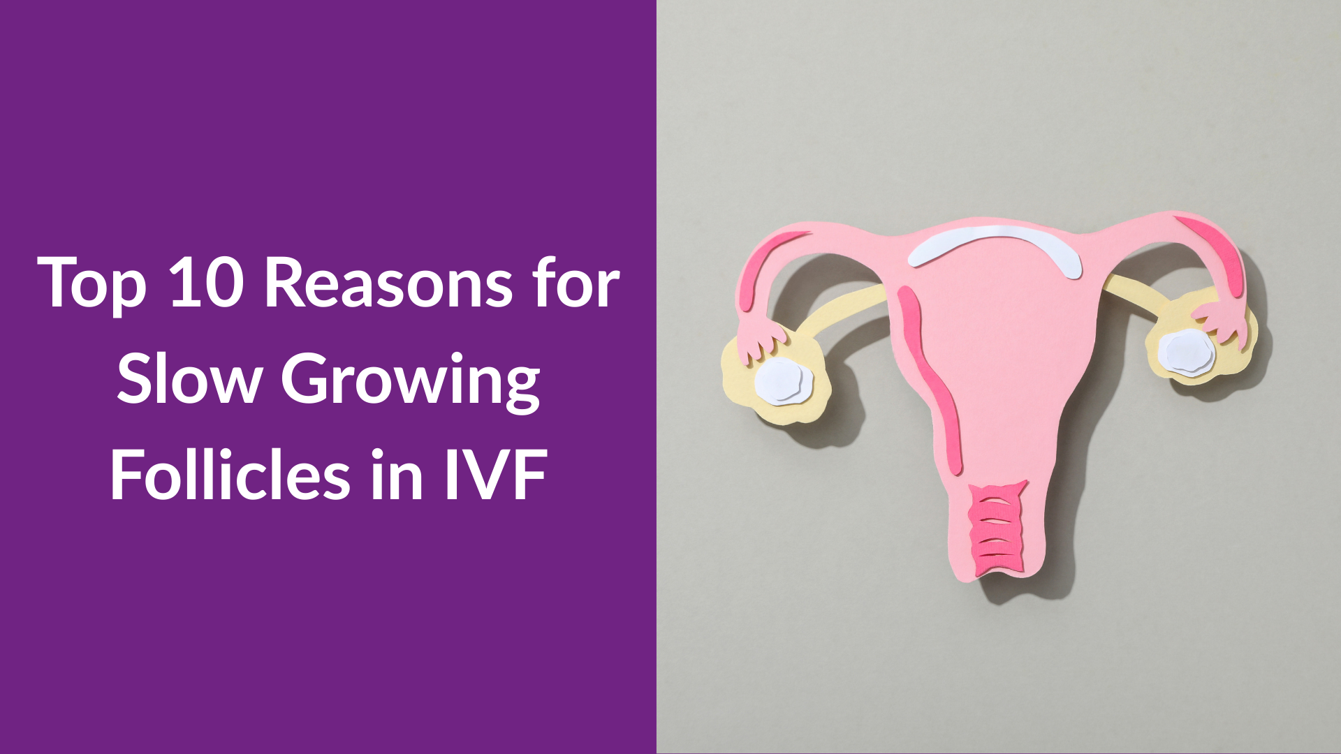 Top 10 Reasons for Slow Growing Follicles in IVF