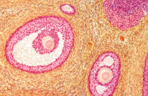 What is Follicle Growth in IVF