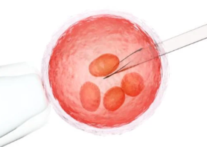 Intrauterine Insemination (IUI)