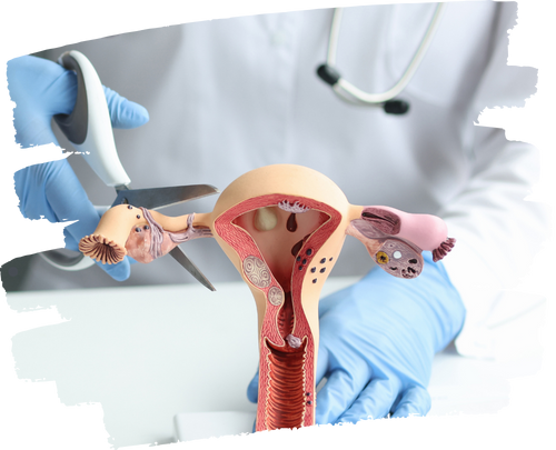 Who Should Consider This Procedure