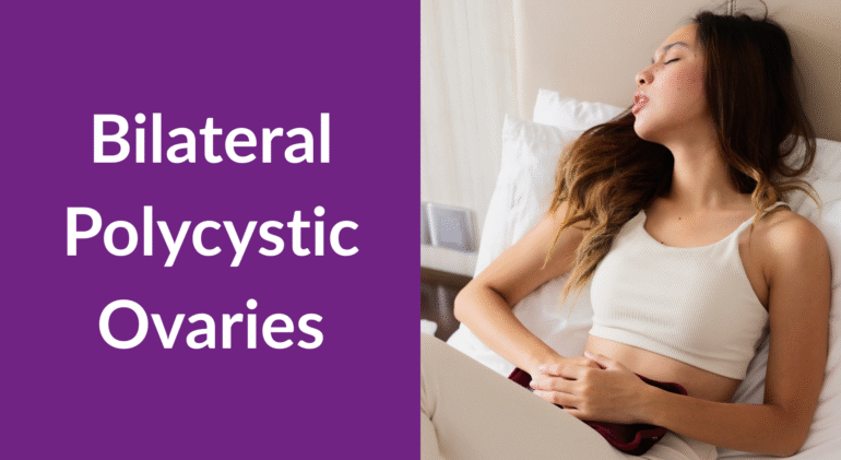 Bilateral Polycystic Ovaries Bilateral Polycystic Ovaries