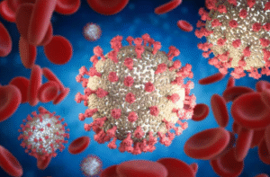Sickle Cell Disease