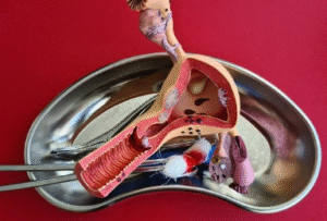 Types of Hysterectomy Surgery