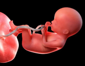 What Is a Low-Lying Placenta